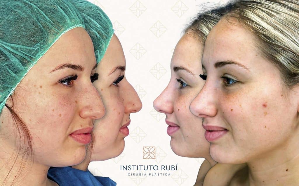 Lado y perfil-14 svg+xml;charset=utf