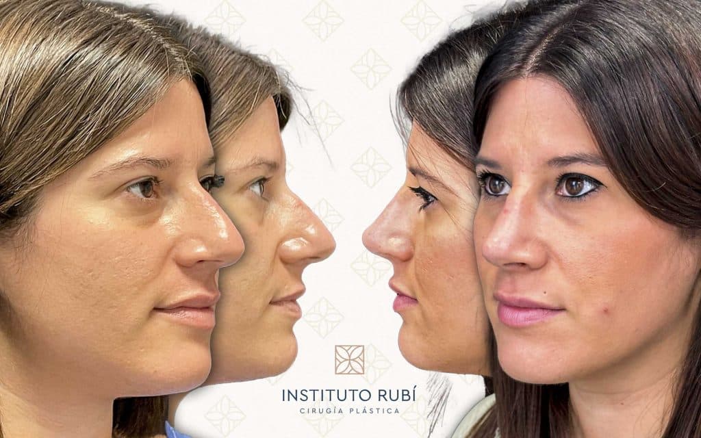 Lado y perfil-15 svg+xml;charset=utf