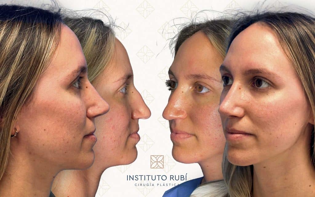 Lado y perfil-16 svg+xml;charset=utf