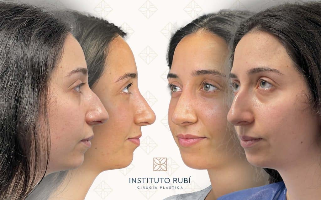 Lado y perfil-2 svg+xml;charset=utf