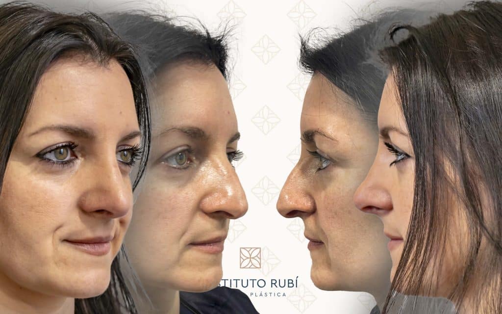 Lado y perfil-3 svg+xml;charset=utf