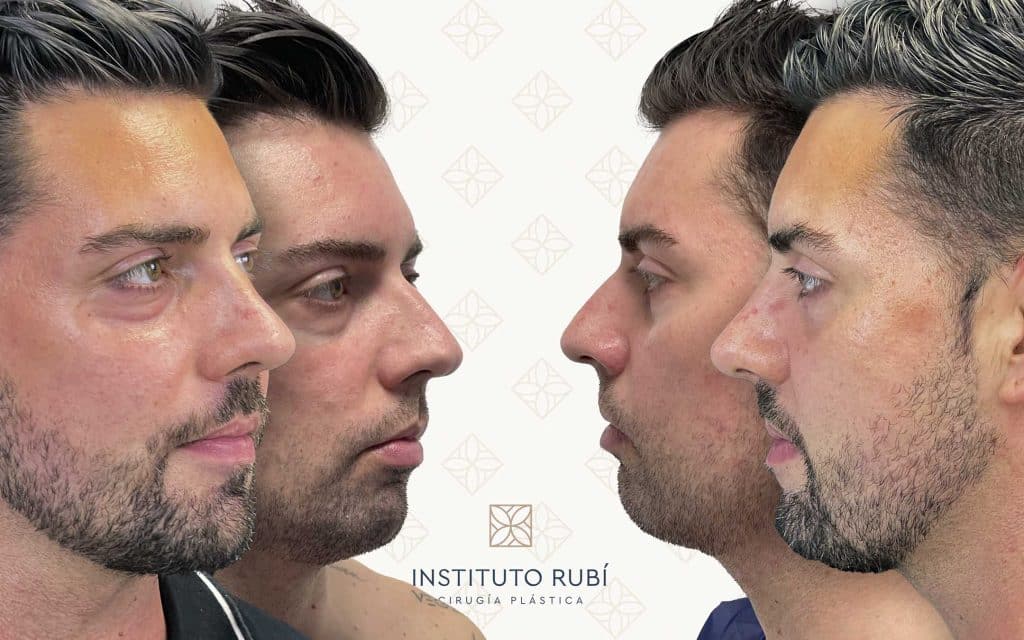 Lado y perfil-6 svg+xml;charset=utf