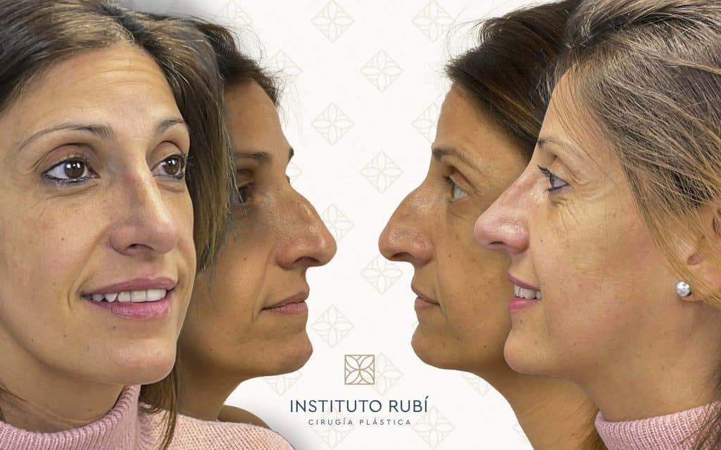 Lado y perfil-7 svg+xml;charset=utf