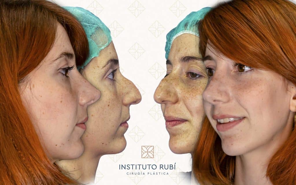 Lado y perfil-9 svg+xml;charset=utf