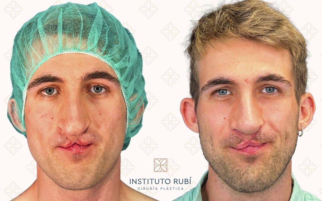 frente-10 svg+xml;charset=utf