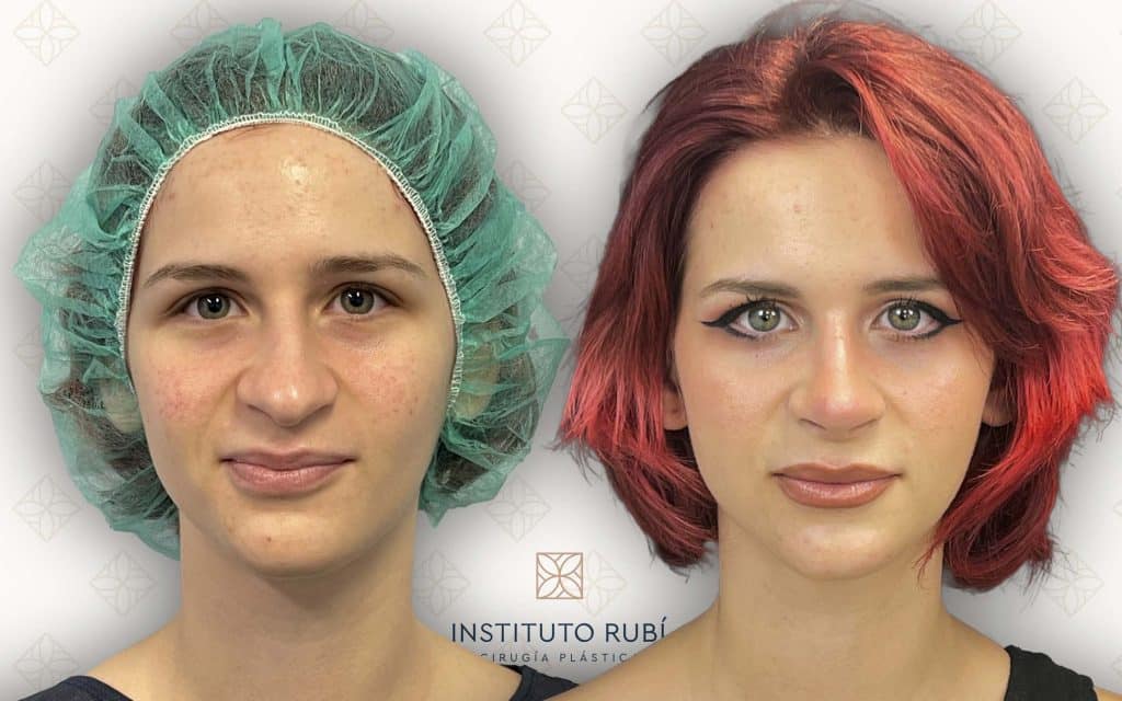 frente svg+xml;charset=utf