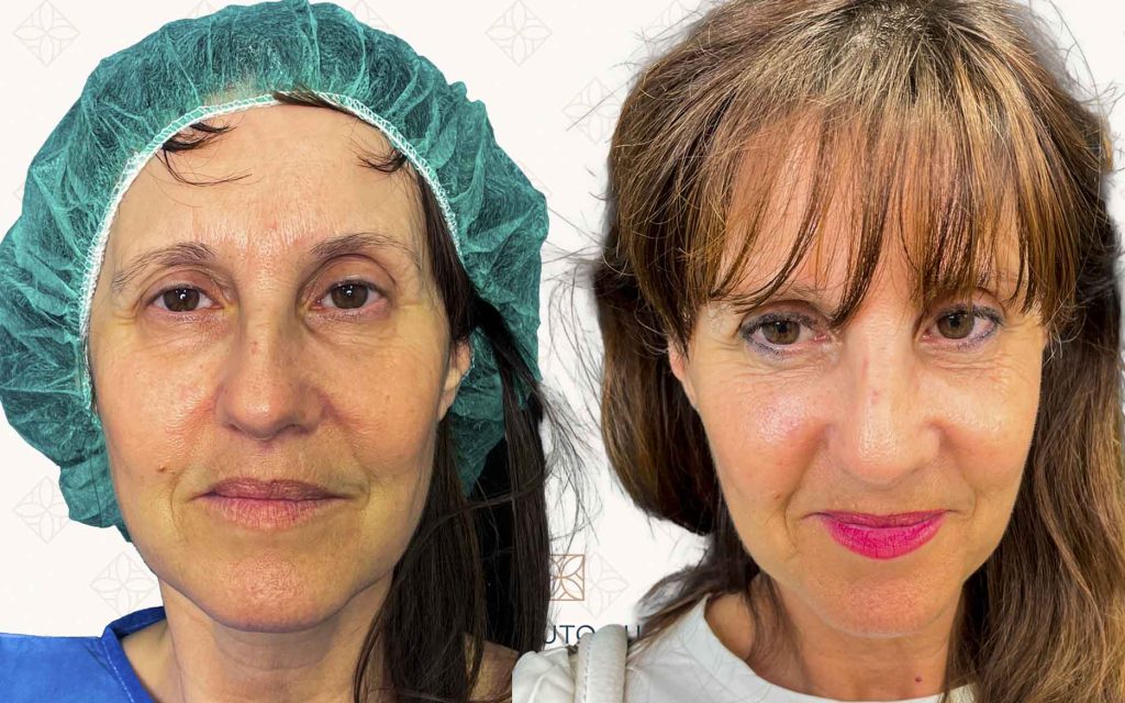 frente-12 svg+xml;charset=utf