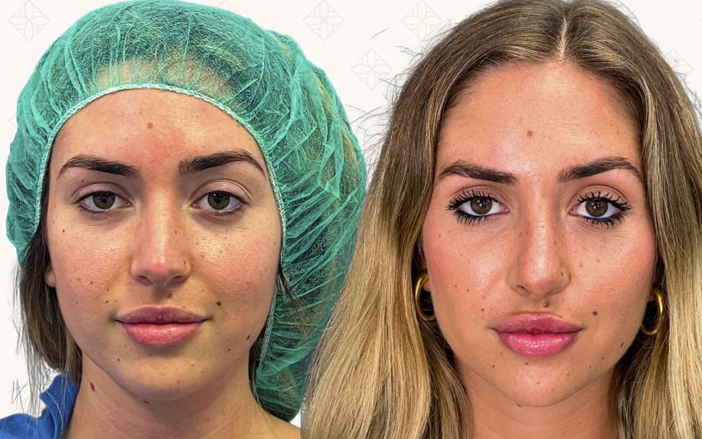 frente-13 svg+xml;charset=utf