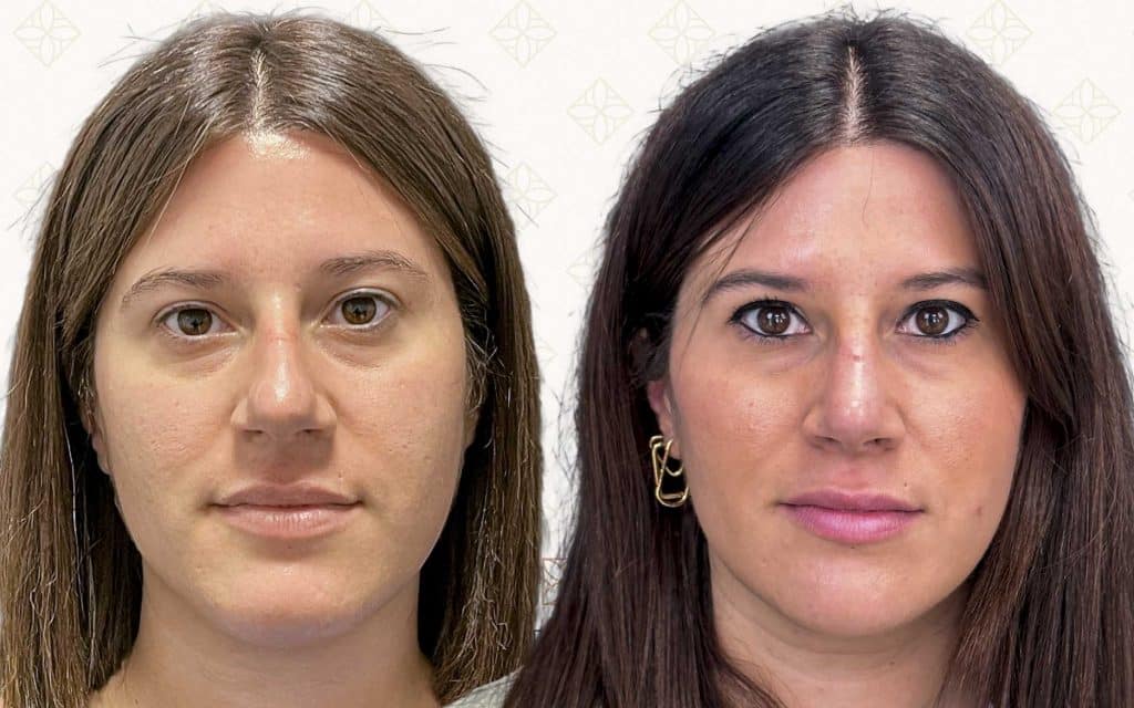 frente-15 svg+xml;charset=utf