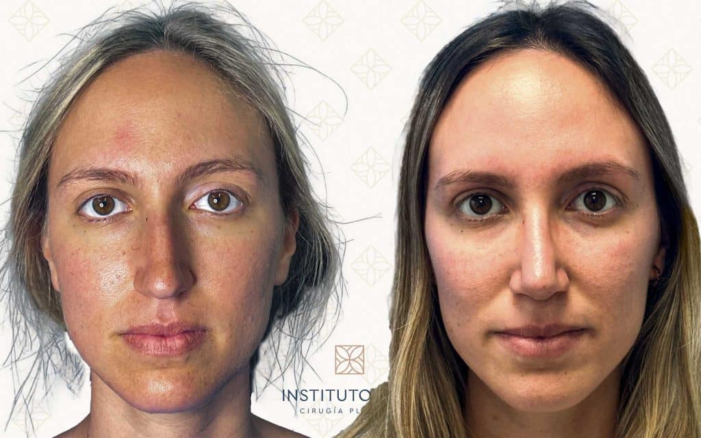 frente-16 svg+xml;charset=utf