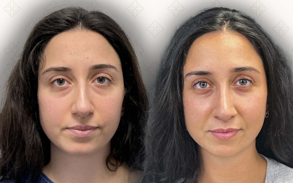 frente-2 svg+xml;charset=utf