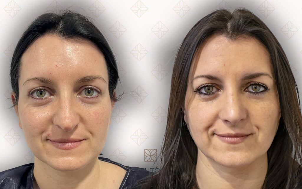 frente-3 svg+xml;charset=utf