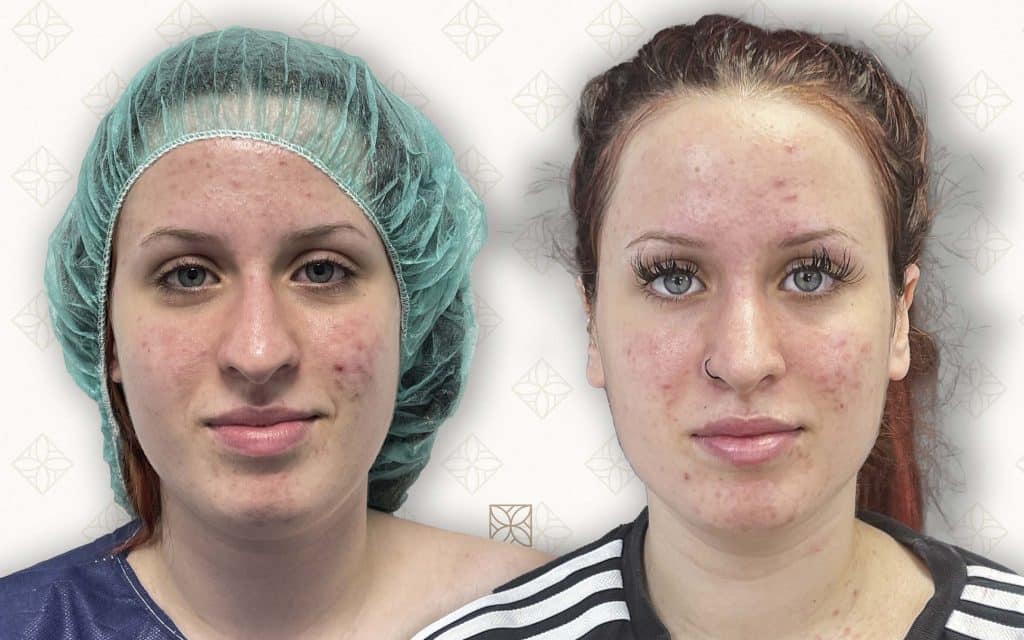 frente-5 svg+xml;charset=utf