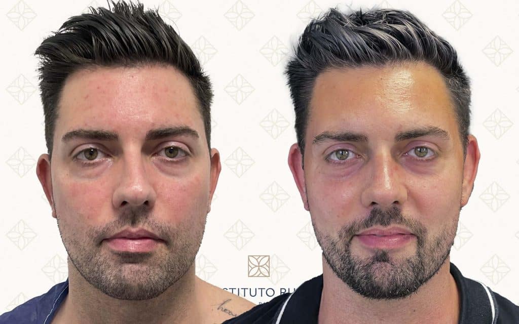 frente-6 svg+xml;charset=utf