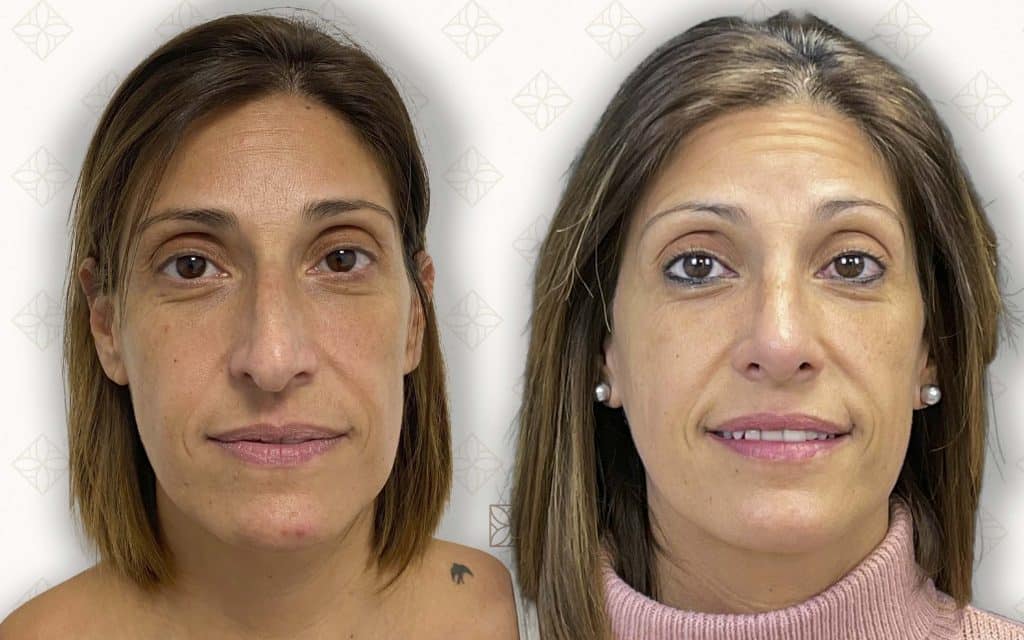 frente-7 svg+xml;charset=utf