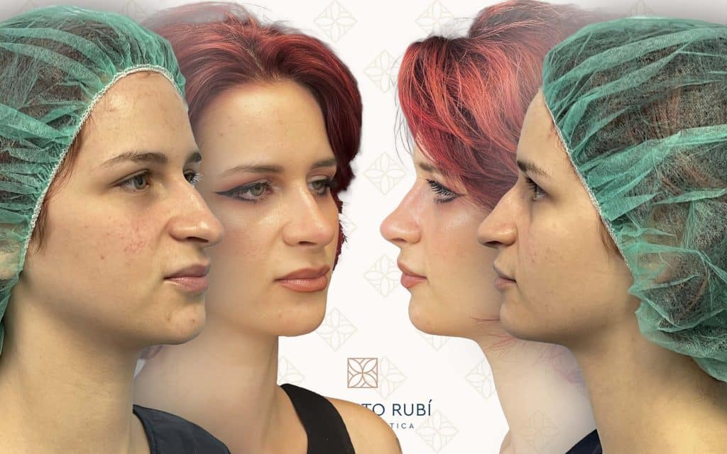 lado y perfil svg+xml;charset=utf