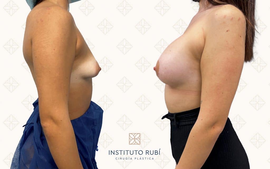 Comparación perfil-2 svg+xml;charset=utf