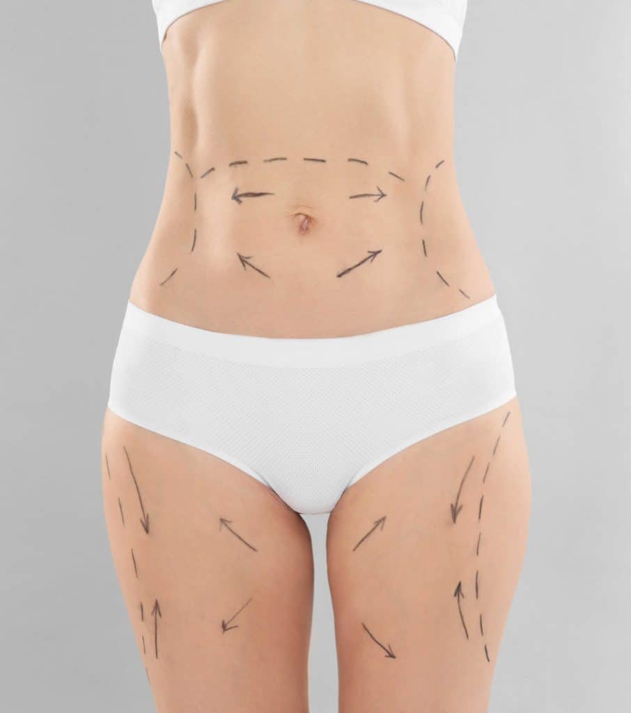 abdominoplastia-barcelona abdominoplastia mallorca