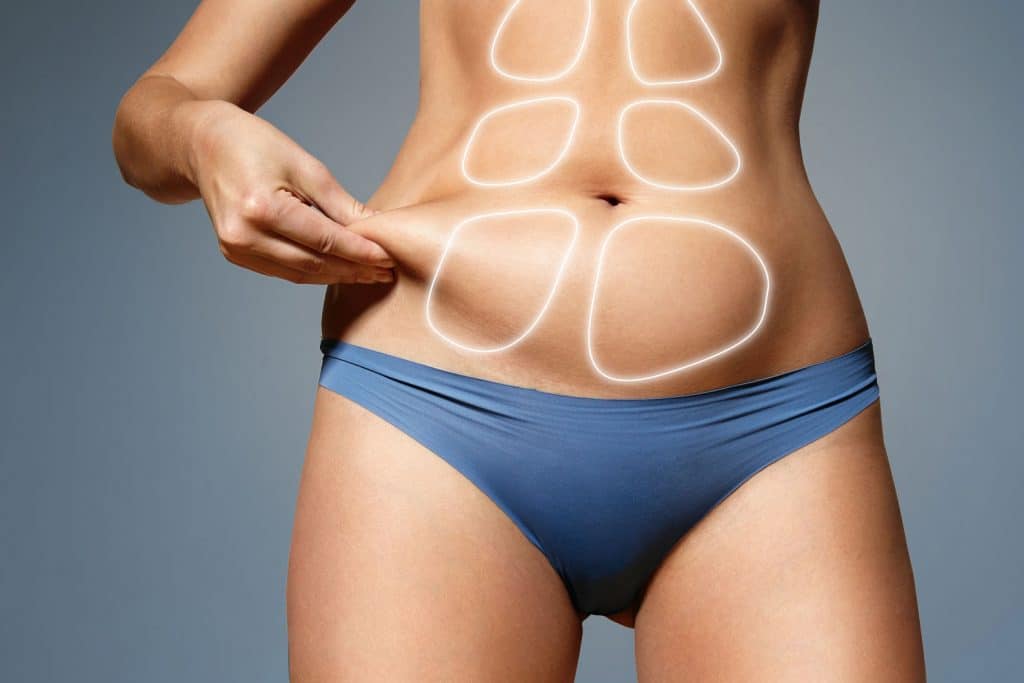 lipofilling La imagen muestra el abdomen de una mujer en ropa interior azul, pellizcando la piel del costado, lo que resalta una pequeña acumulación de grasa abdominal. Sobre el abdomen hay dibujos digitales en forma de rectángulos redondeados que simulan la forma de los músculos abdominales marcados (six-pack), comúnmente utilizados para ilustrar procedimientos como marcación abdominal o lipomarcación. Es una representación visual típica en contextos de cirugía estética o tratamientos corporales para definir el abdomen.