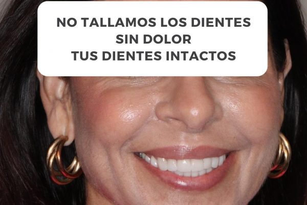 Nuestra paciente vino con una idea clara- quería verse mejor y sentirse más segura con su sonris (1)