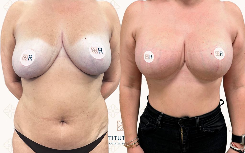 frente-6 svg+xml;charset=utf